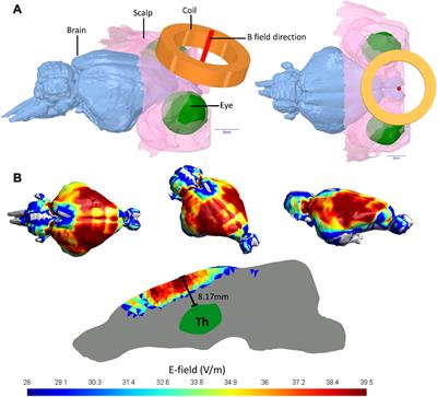 Excitatory Repetitive Transcranial Magnetic Stimulation Over Prefrontal Cortex in a Guinea Pig Model Ameliorates Tinnitus